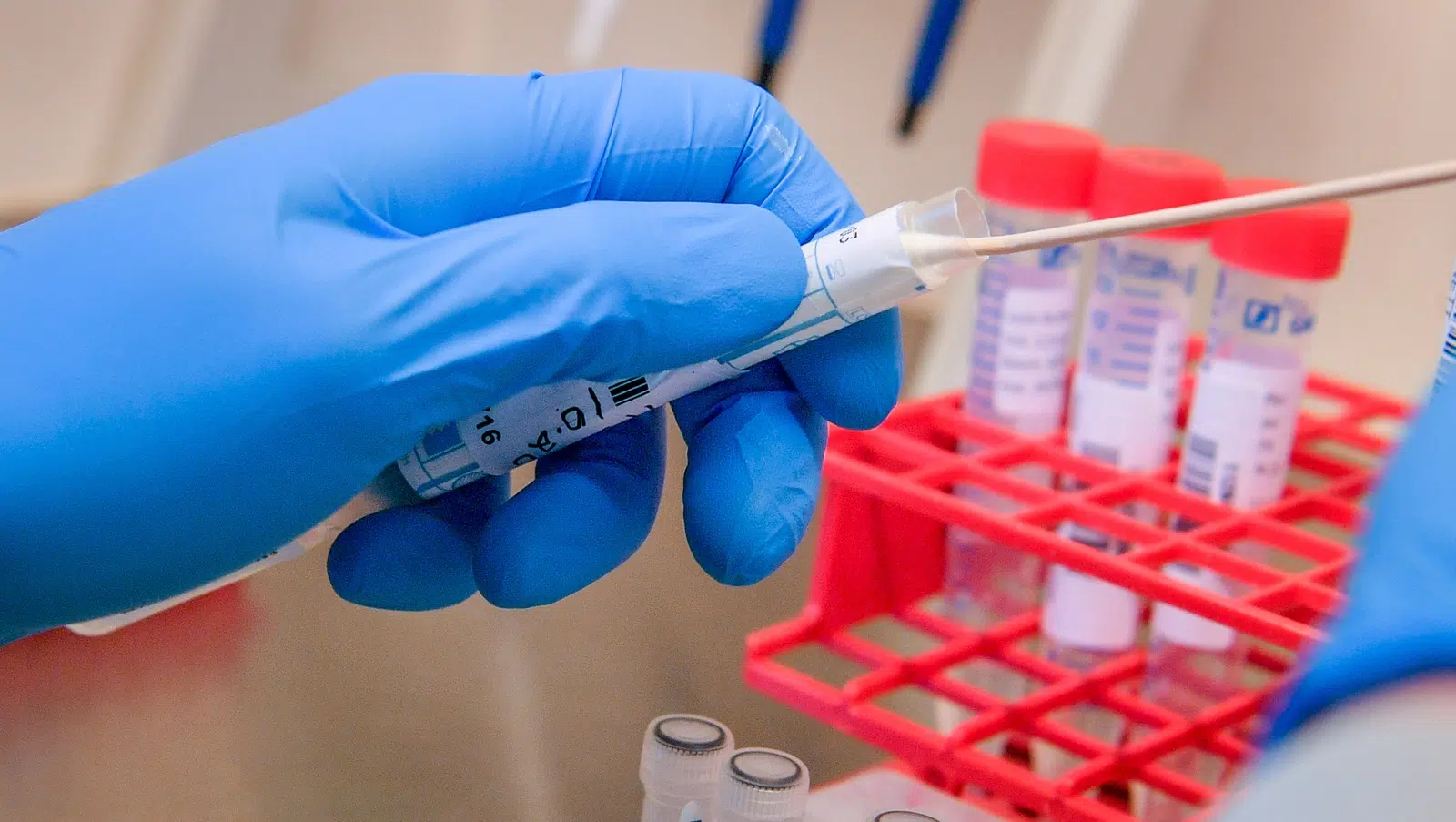 COVID 6 new deaths and 5 new confirmed cases 1 new case in