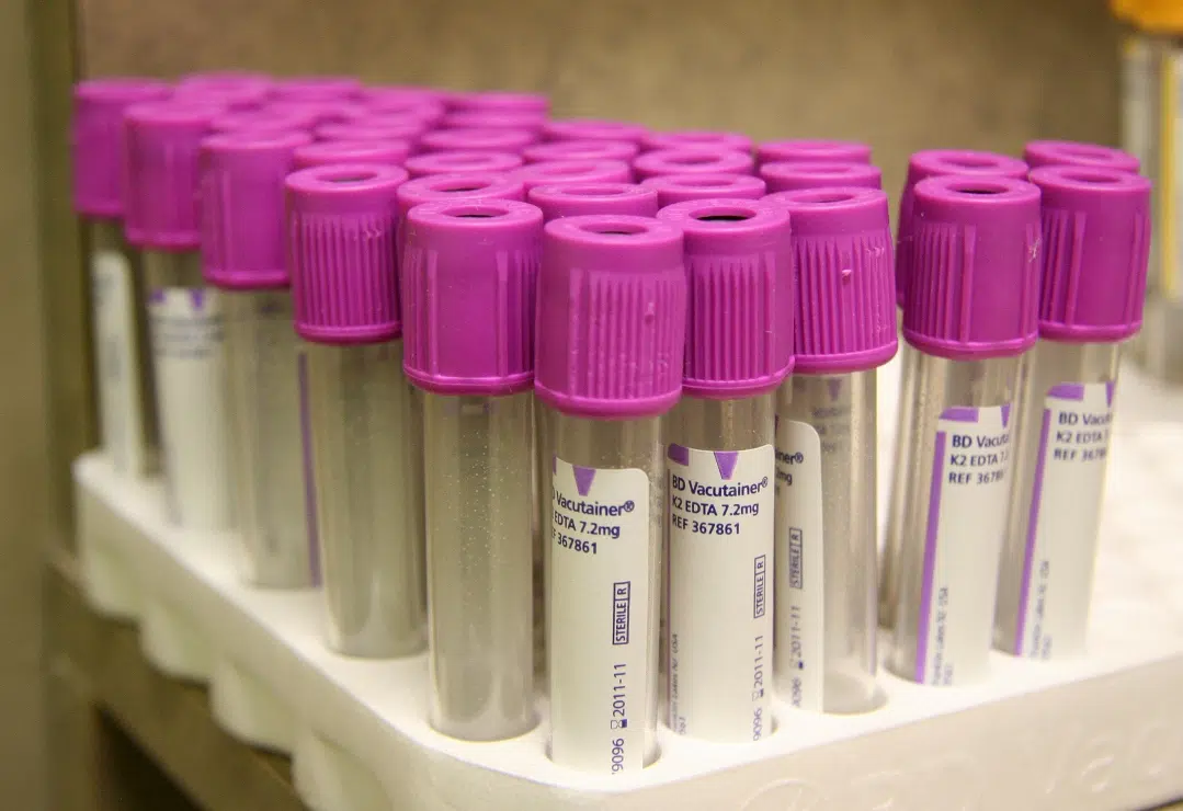 Victoria Hospital set to replace current Laboratory Information System