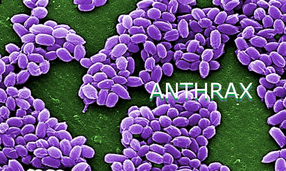 Anthrax Confirmed In Seven Animal Deaths Country 600 CJWW   Anthrax 