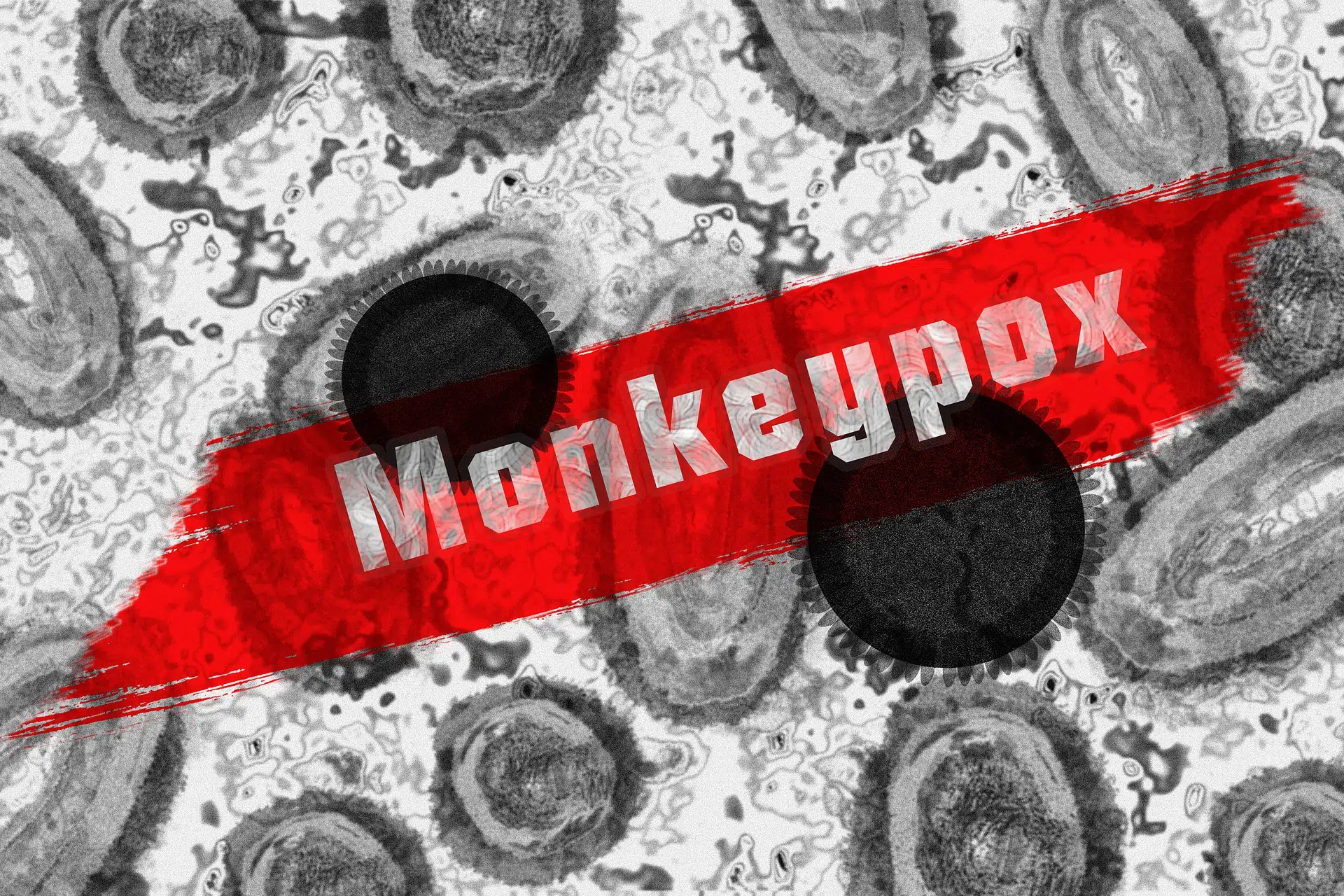 WHO declares Monkeypox global health emergency
