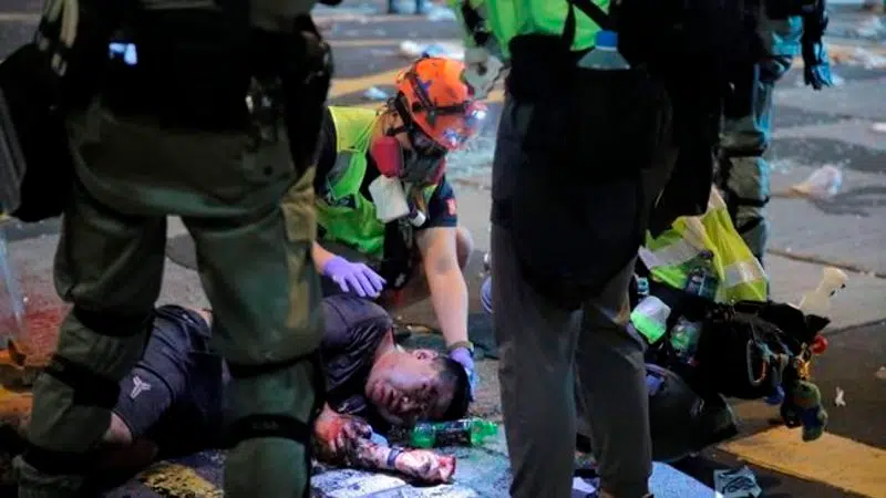 Hong Kong Police Shoot Protester Man Set On Fire Larongenow