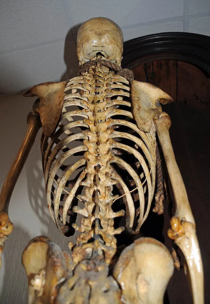 John Horwood's skeleton