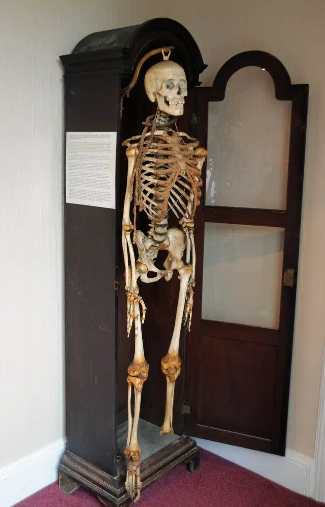 John Horwood's skeleton 