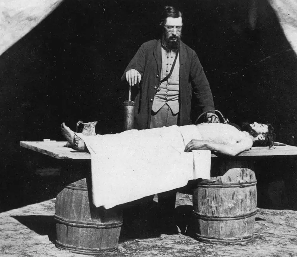 civil war embalming