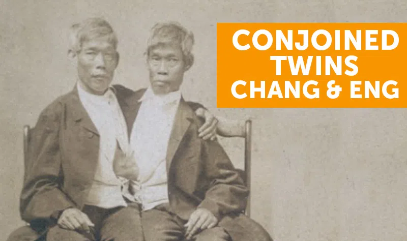 conjoined twins chang and eng