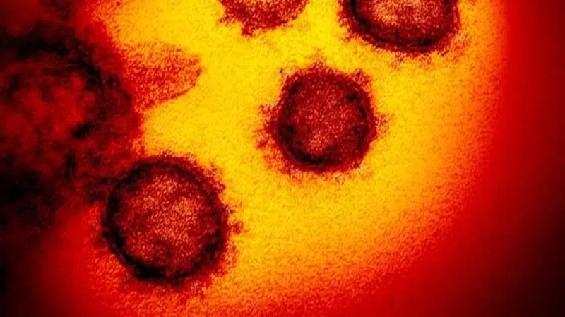 No new coronavirus cases in Ontario today, but 102 cases under investigation