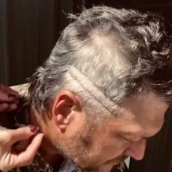 Blake Shelton Mullet Today S Froggy 99 9 Kvox