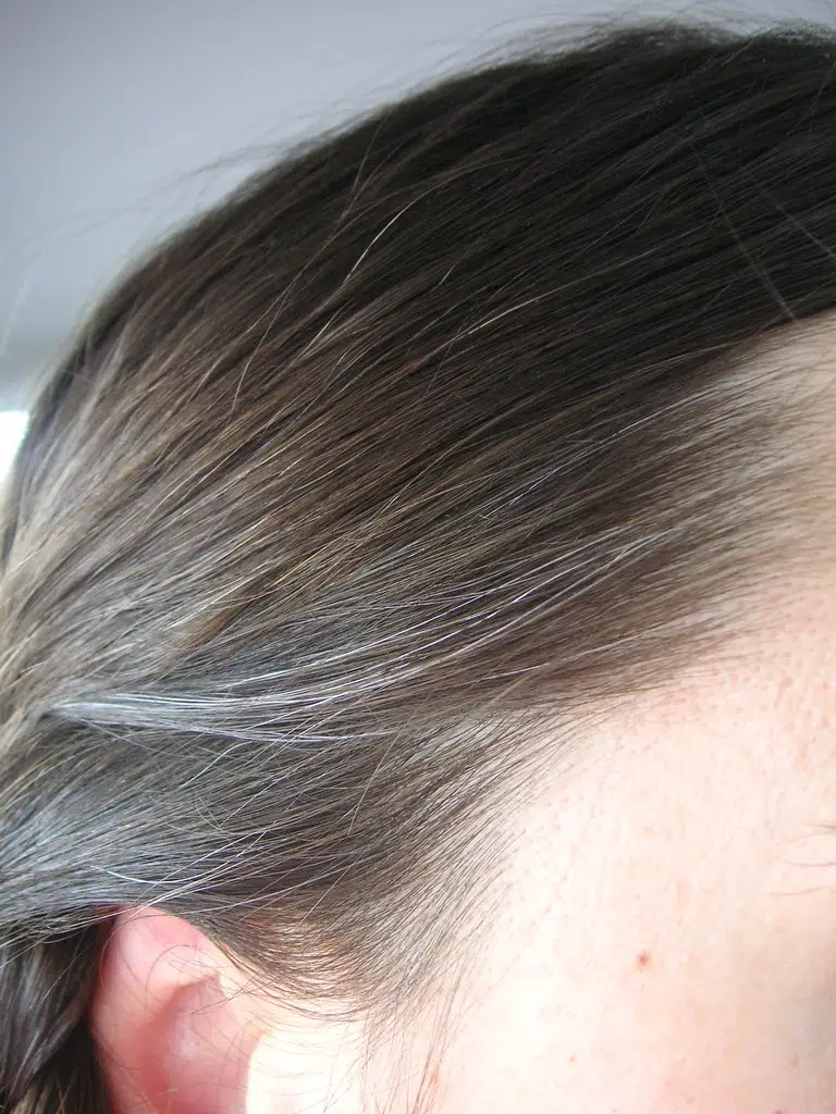 STUDY: Stress Does Give You Grey Hair, But You Can Reverse It: | Arise  Christian Radio AM 1380