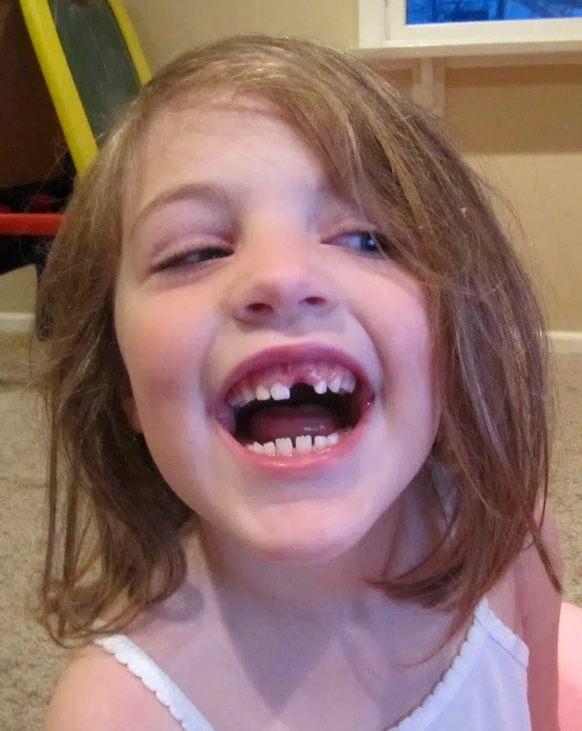 What’s the Tooth Fairy’s going rate for kid’s teeth these days LITE