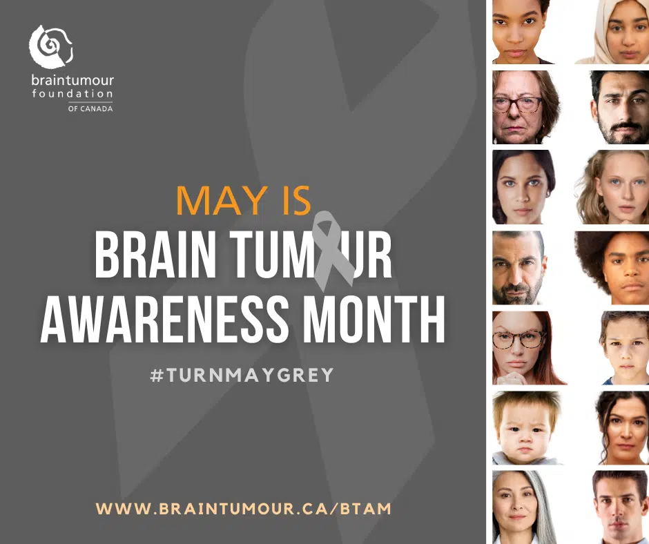 Turn May ‘grey With The Brain Tumour Foundation Of Canada Y955 