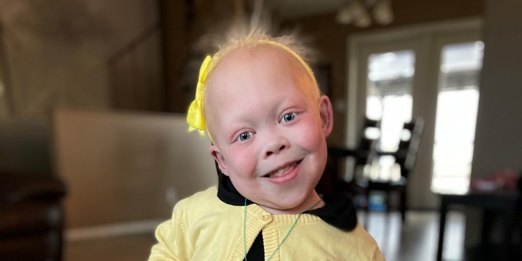 Bella Thompson is bravely waiting for an organ transplant - Vimarsana News
