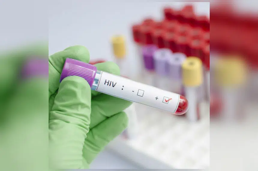 Record number of HIV cases reported in Saskatchewan
