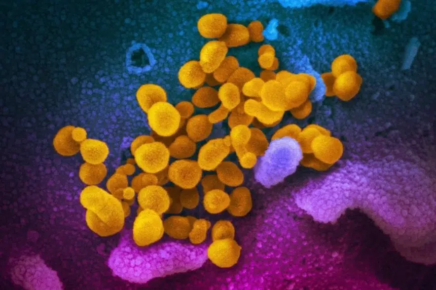 Fighting the COVID-19 pandemic could herald a rise in superbugs